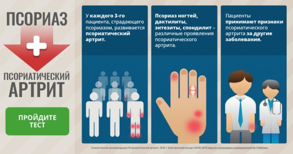 Псориатический артрит