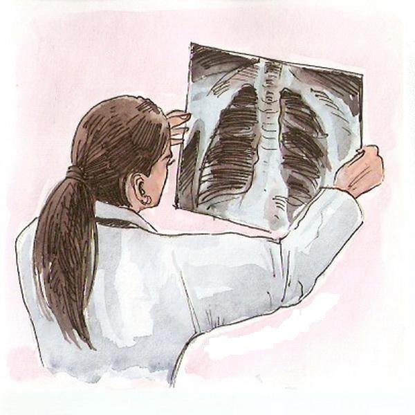 Туберкулез рисунок