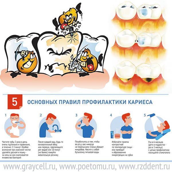Основные меры профилактики кариеса