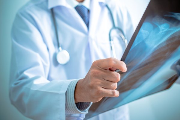 Врач с рентгеновским снимком