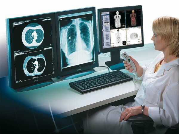 Компьютеры в медицине