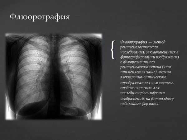 Флюорография метод исследования