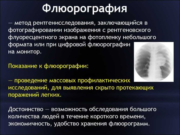 Флюорография метод исследования