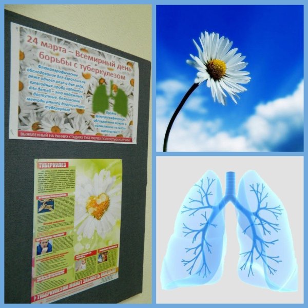 Борьба против туберкулеза