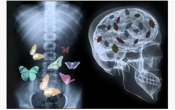 Бабочкин в живота рентген