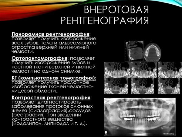 Внеротовые методы рентгеновского исследования