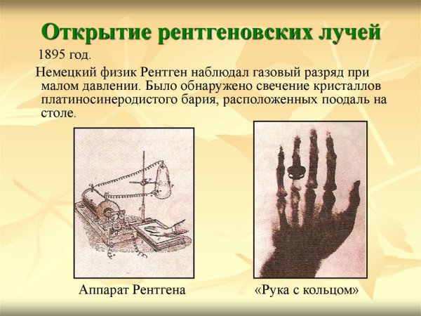 Открытие рентгеновских лучей