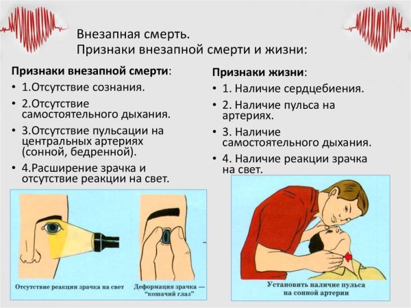 Признаки смерти человека
