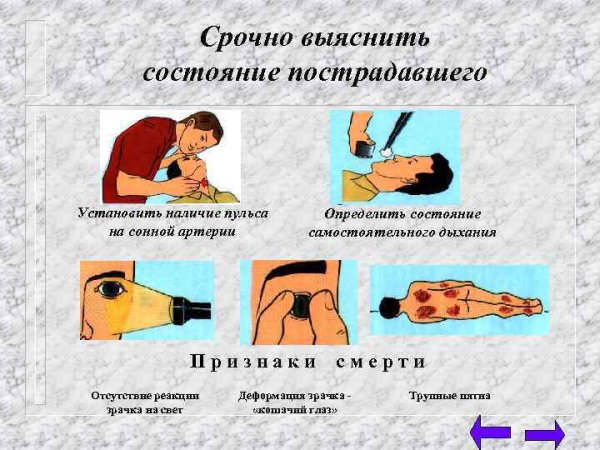 Наличие пульса на сонной артерии пострадавшего определяется