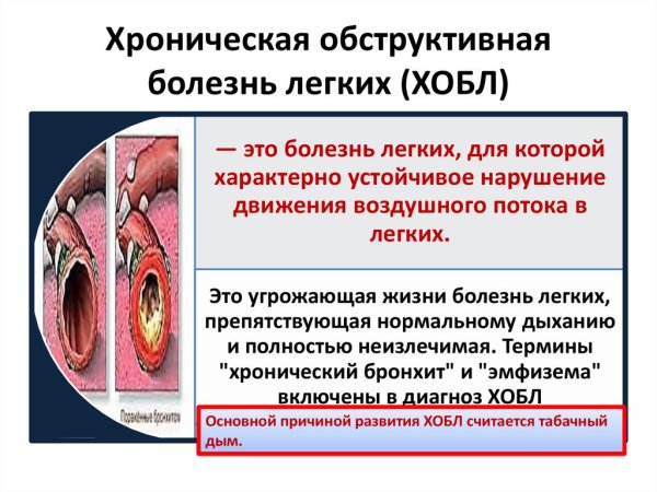 Лгхроническая обструктивная болезнь лёгких