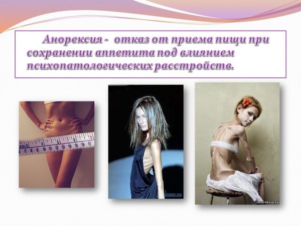 Анорексия презентация