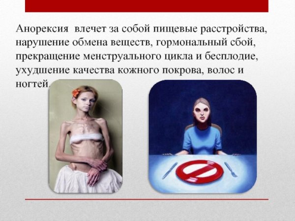 Анорексия презентация