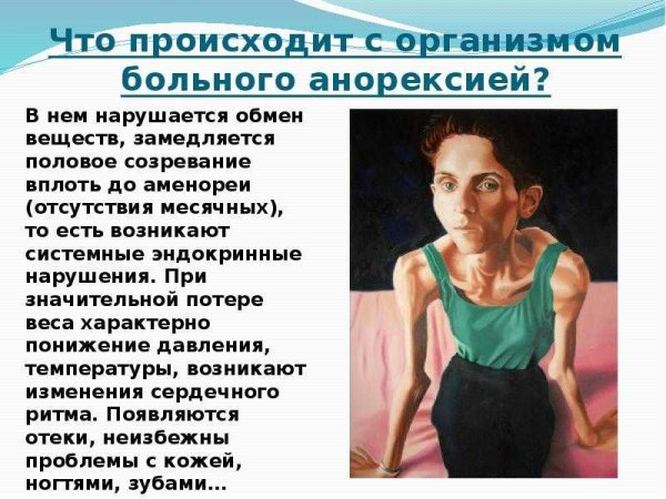 Заболевание анорексия