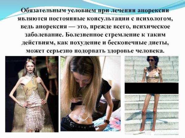 Психологическая анорексия