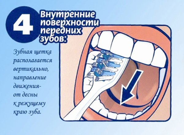Как правильно чистить зубы