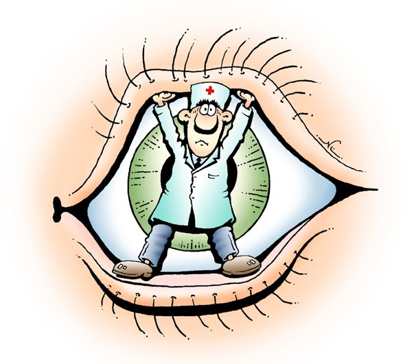 Офтальмолог карикатура