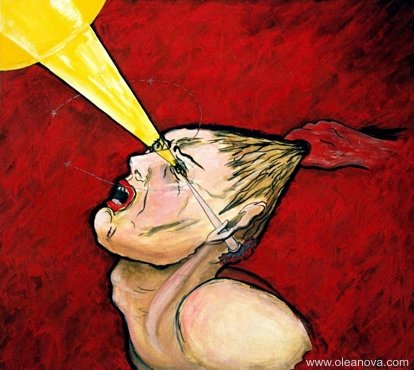 Мигрень картина