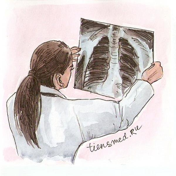 Туберкулез рисунок