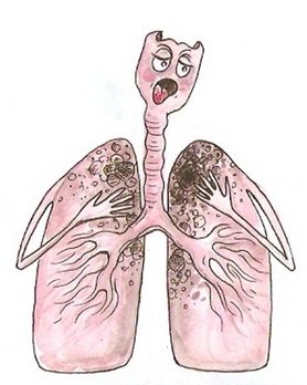 Флюорография карикатура