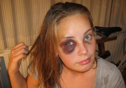 Синяк картинка с надписью для конкурса