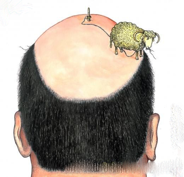 Лысина на голове у мужчин смешные