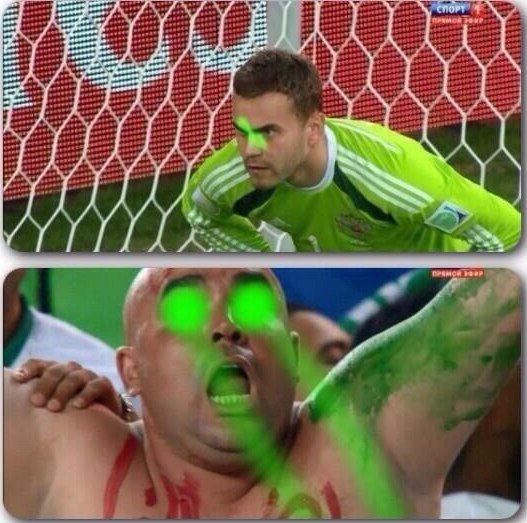 Нога акинфеева карикатура (48 фото)