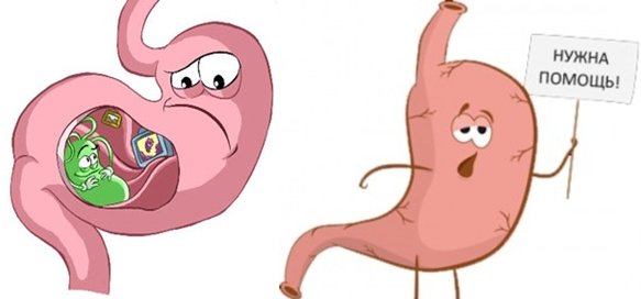 Гипоацидность желудочного сока