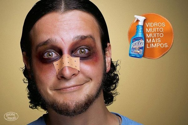 Синяки у парня смешные