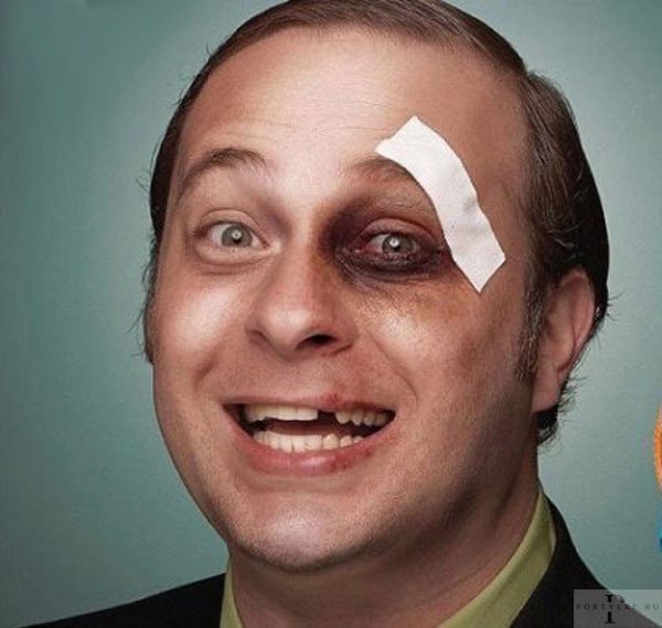 Конкурс подарок синяк под глазом