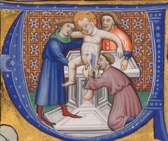 Пармиджанино обрезание Иисуса