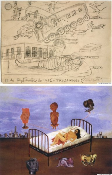 Фрида Кало госпиталь Генри Форда