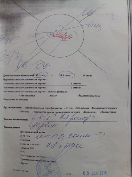 Кольпоскопическая картина классификация