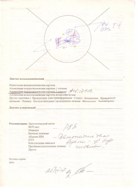 Кольпоскопическая классификация таблица