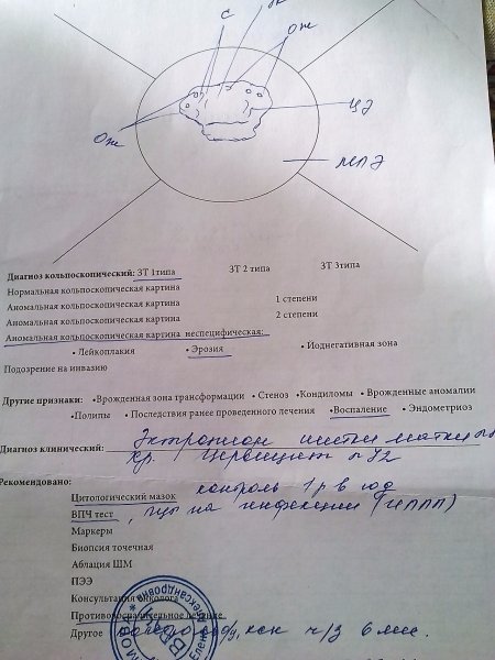 Диагноз кольпоскопический