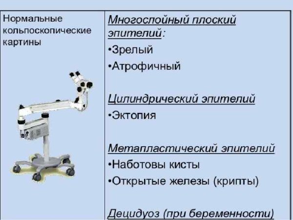 Аномальные кольпоскопические картины степень 1