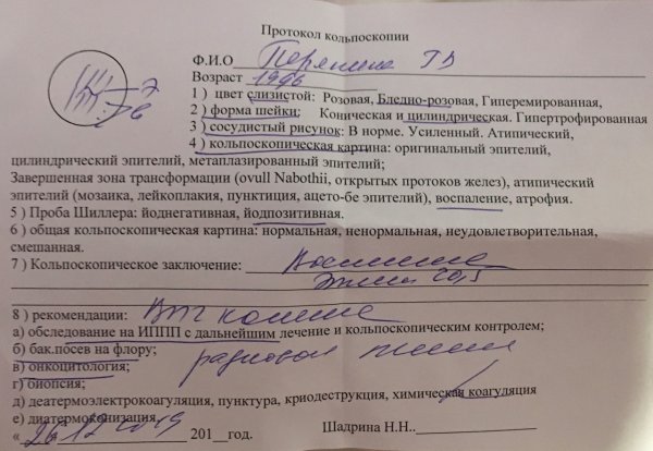 Ацетобелый эпителий кольпоскопия