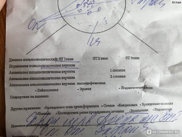 Заключение кольпоскопии расшифровка