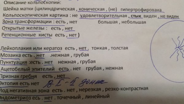 Кольпоскопия классификация