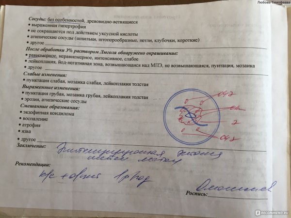 Шейка матки ацетобелый эпителий