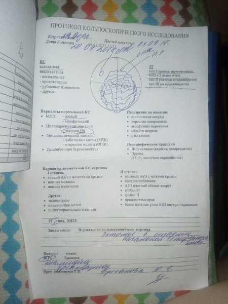 Кольпоскопия шейки матки йоднегативная зона