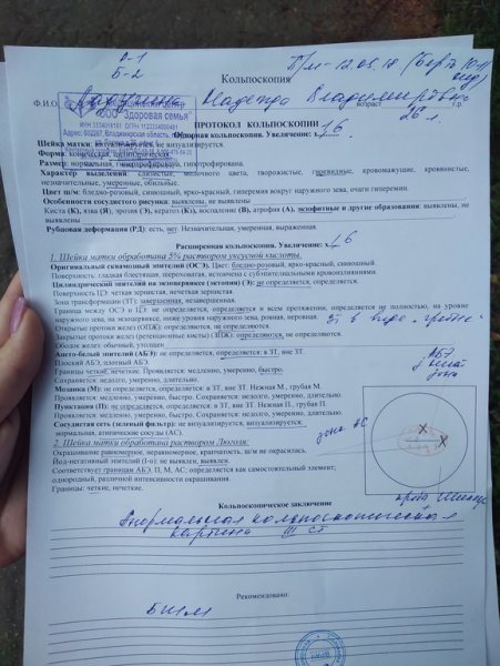 Протокол кольпоскопии расшифровка ВПЧ