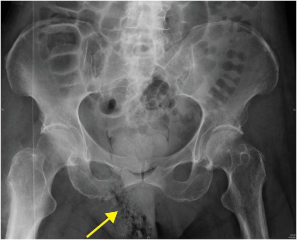 Фурнье картины Фурнье