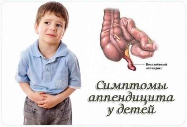 Аппендицит у детей