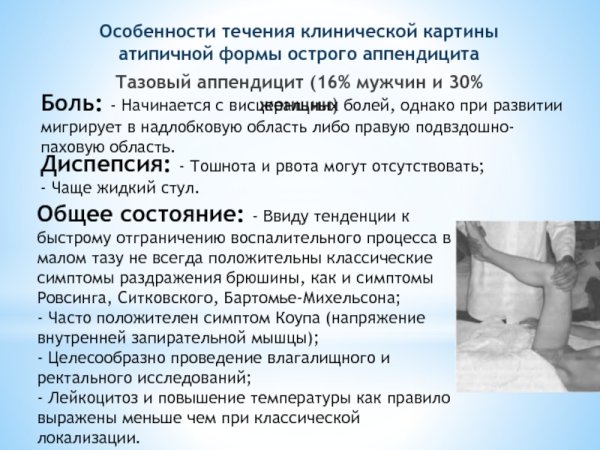 Особенности течения аппендицита