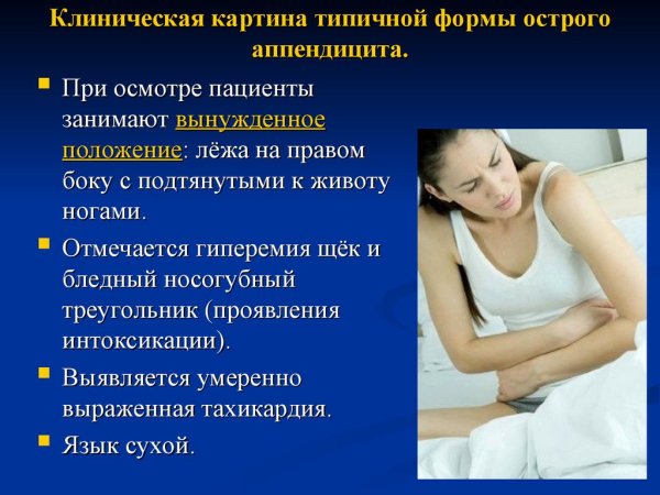 УЗИ признаки аппендицита