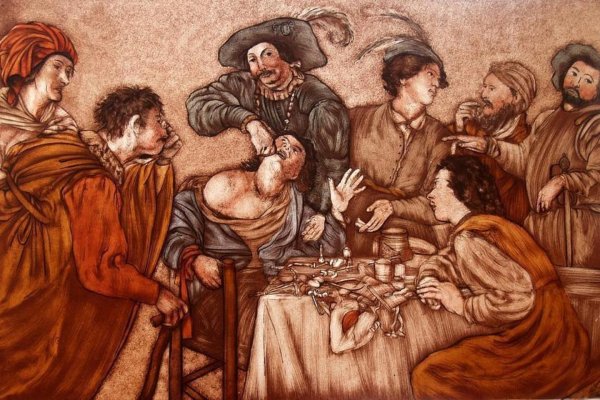 Бродячие Зубодеры в средневековье