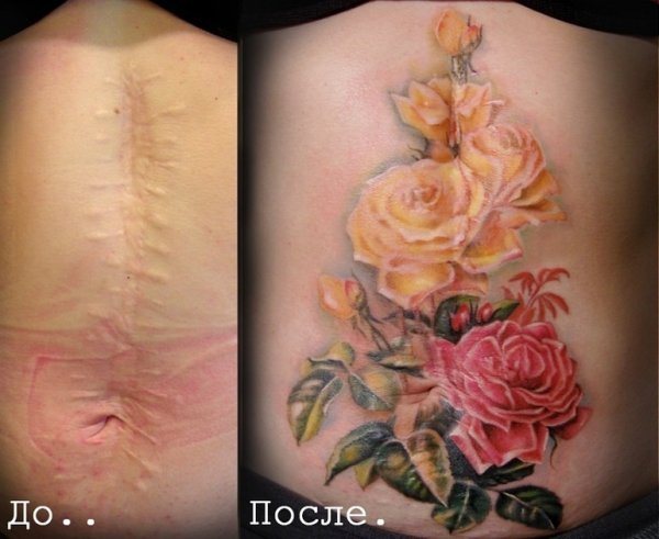 Татуировка на маленький шрам