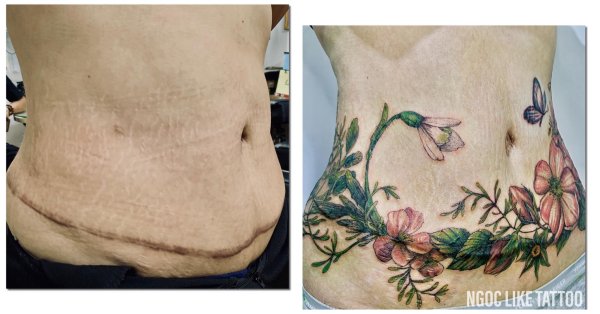 Татуировка на шраме от кесарева