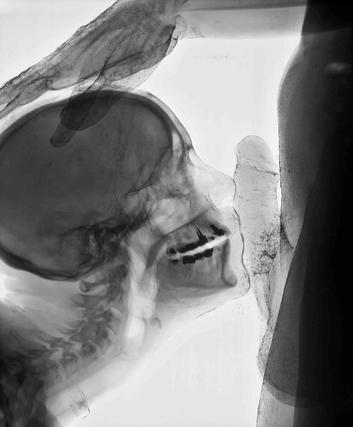 ВИМ Дельвуа. Wim Delvoye