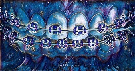 Брекеты прикольные арты